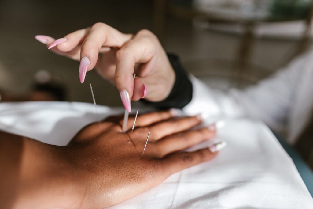 Trattamento dry needling a Larciano